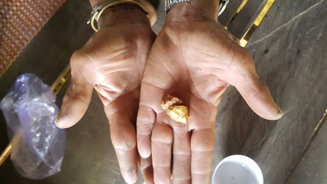 Vạch trần thủ đoạn lừa bịp của các lang băm